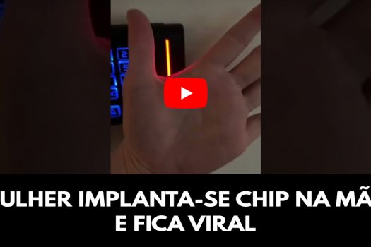 Mulher implanta-se chip na mão e fica viral