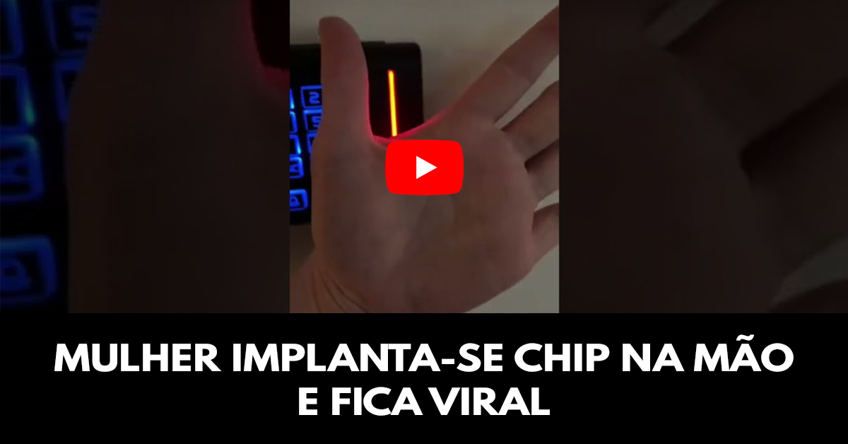 Mulher implanta-se chip na mão e fica viral